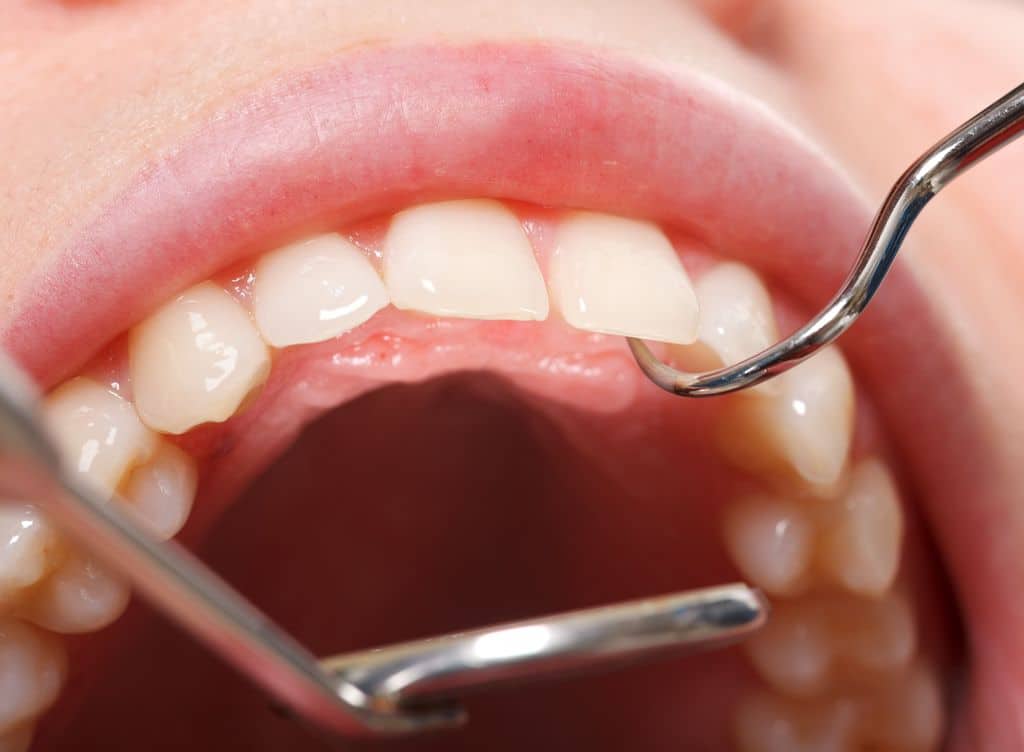 Bei Zahn- und Zahnfleischproblemen: Wie Sie Ihre Mundhygiene verbessern