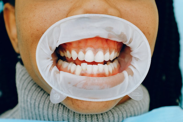 Was Mundhygiene mit Ihrem Gehirn zu tun hat