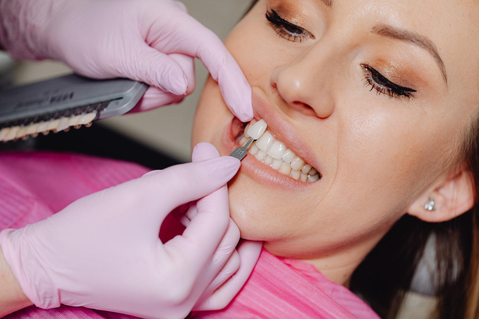 Professionelles Bleaching:  Zu Hause oder besser beim Zahnarzt?