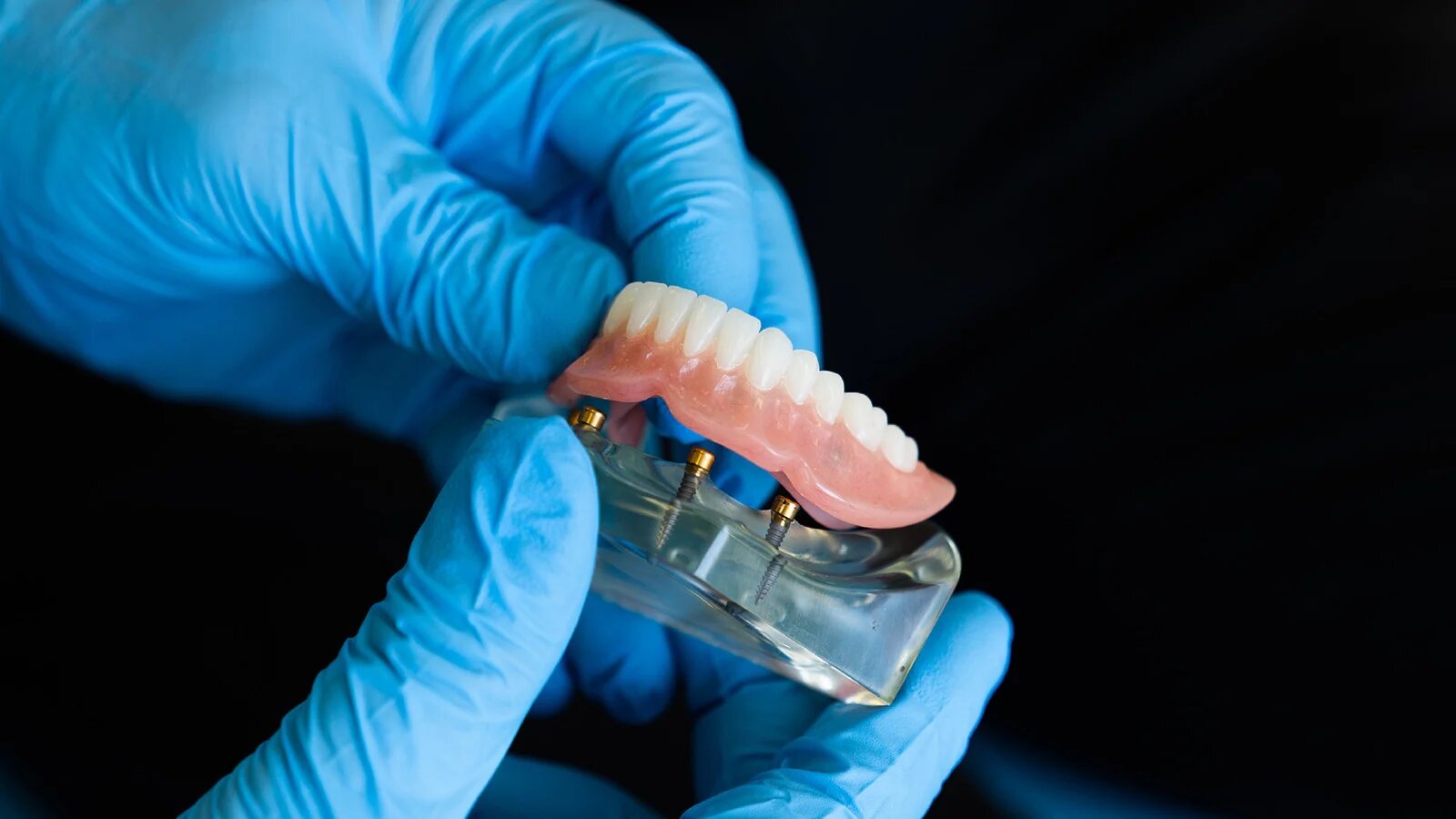 Zahnersatz: Was bei der Mundhygiene zu beachten ist